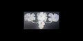 Triple Bow Pom Pom Pram Charm